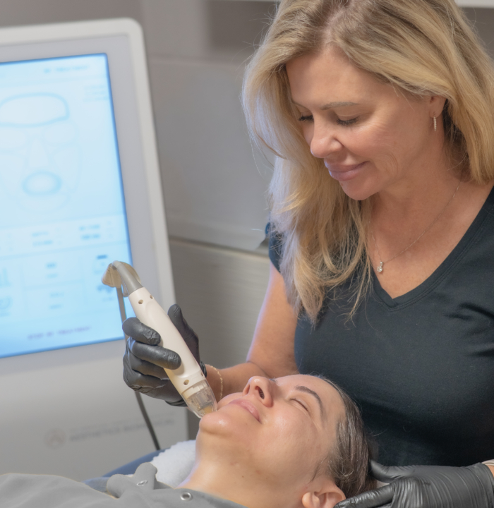 RF microneedling at Grand Salon & MedSpa