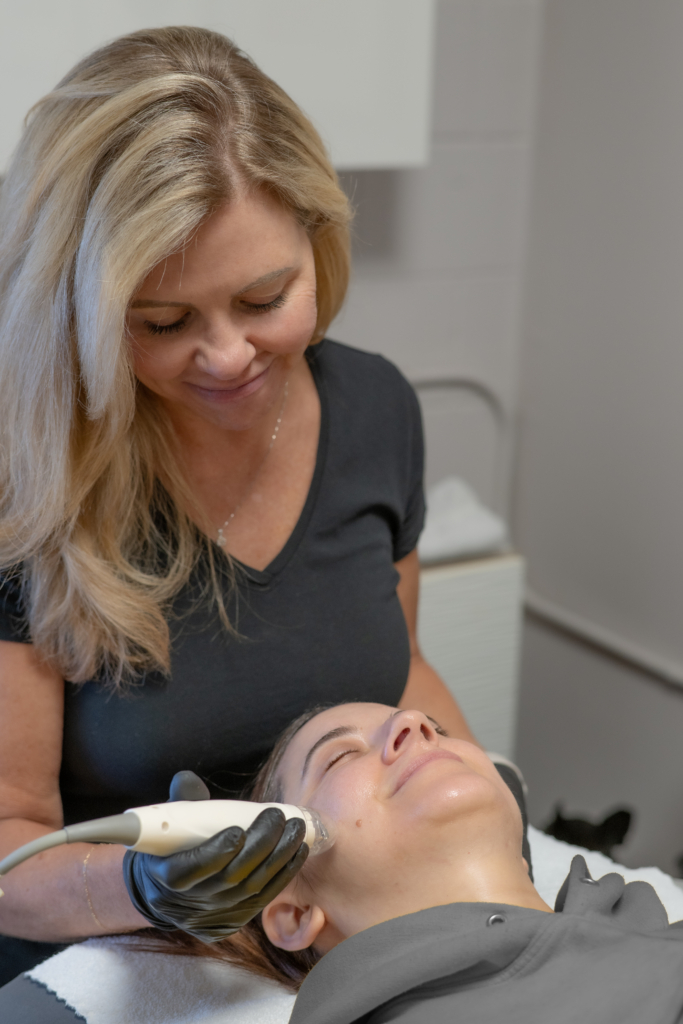 Carrie Meis, RF Microneedling at Grand Salon & MedSpa