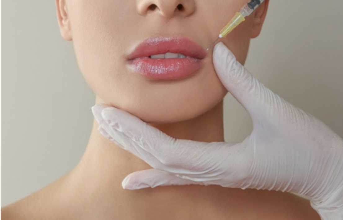 Filler Promotion at Grand Salon & MedSpa